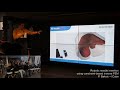 Robotic needle insertion using constraint based inverse FEM – P. Baksic – ICube