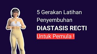 Ini dia Penjelasan Terapi DIASTASIS RECTI !