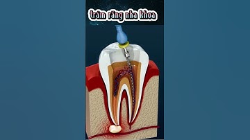 cận cảnh trám răng sâu #thegioithuvi #bietthemmotchut