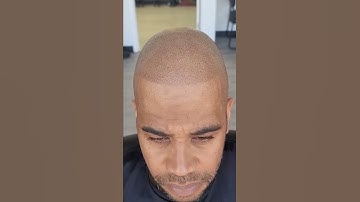 Scalp Micropigmentation  Results don’t lie
