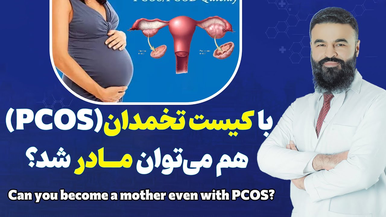 تداوی کیست تخمدان برای مادر شدن| داکتر قیس نیکزاد