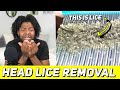 REACTING TO EXTREME HAIR LICE