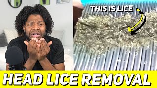 REACTING TO EXTREME HAIR LICE