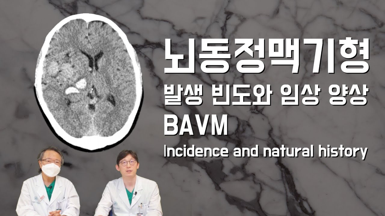 [뇌동정맥기형 전문가용] 유병률, 출혈 발생 빈도 Prevalence of the brain AVM and incidence of hemorrhagic complication