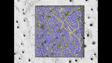 Segmentation of Cortical bone from microCT 50(nanoCT)