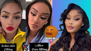 Online crazy reaction to ZARINA new  F🅰️CELIFT accused her of wanting HAMISA'S natural look