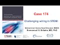 Case 174 Manual Of PCI Challenging Wiring In STEMI Case 174 Manual Of PCI Challenging Wiring In STEMI