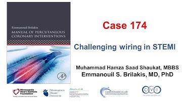 Case 174: Manual of PCI - Challenging wiring in STEMI