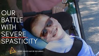Brysons Severe Spasticitydystonia Raw Footage And How We Manage It