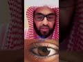 كلام النبي عن كحل الاثمد و فعاليته على العين وكيف هو يعتر مفيد جدا 