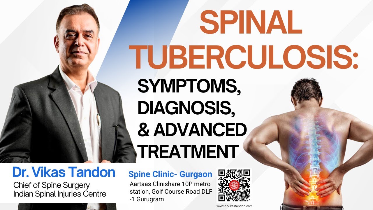Spinal Tuberculosis: Symptoms, Diagnosis, and Advanced Treatment  