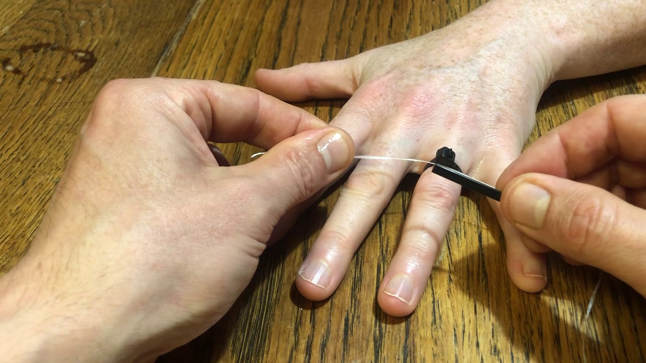 Novel stuck ring removal technique YouTube