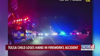 Tulsa child loses hand in fireworks accident