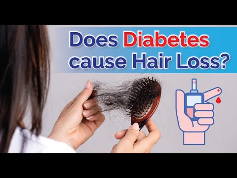 Does Diabetes Cause Hair Loss? Diabetes and Hair Loss | Reasons For Hair  Fall in Diabetes - thptnganamst.edu.vn