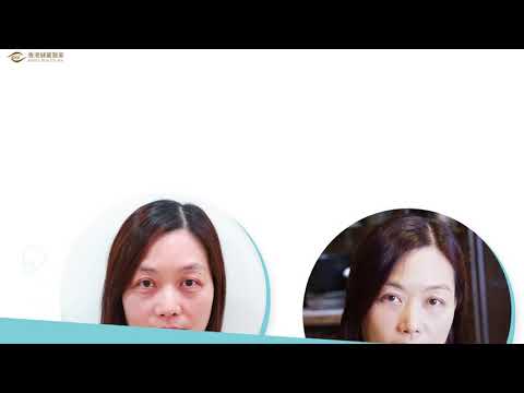 如何去除大眼袋？怎麼去除大眼袋？