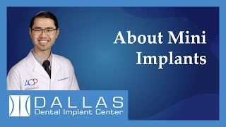 Dr Tan - About Mini Implants