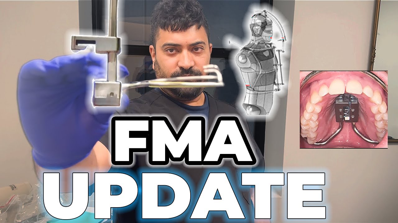 FMA UPDATE -Dr. Newaz & Dr. Jaffari