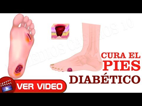 tratamiento-para-curar-el-pie-de-un-diabético-de-manera-natural-sólo-necesitas-este-ingrediente