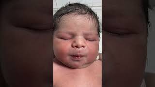 Cute Little Newborn Baby in NICU | Warm Care Just After Birth ❤️👶