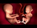 प्रेगनेंसी में जुड़वा बच्चे हो तो ऐसे रखें अपना ध्यान  | How to care twin pregnancy | Pregnancy tips