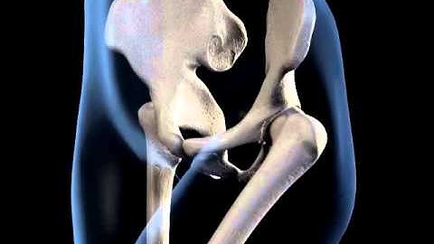 3D medical animation - hip joint range of movement