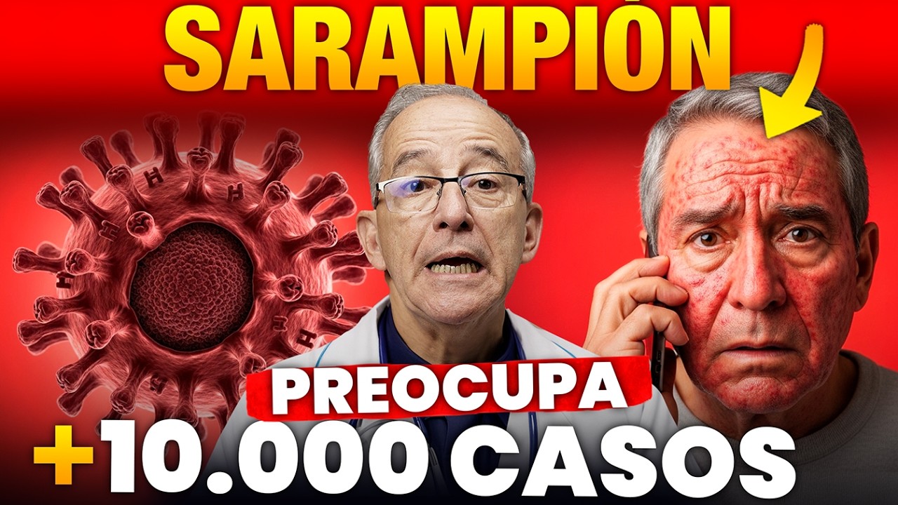 PORQUE ES TAN PREOCUPANTE EL SARAMPION