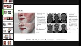 Clinical Photography Consult Video screenshot 5