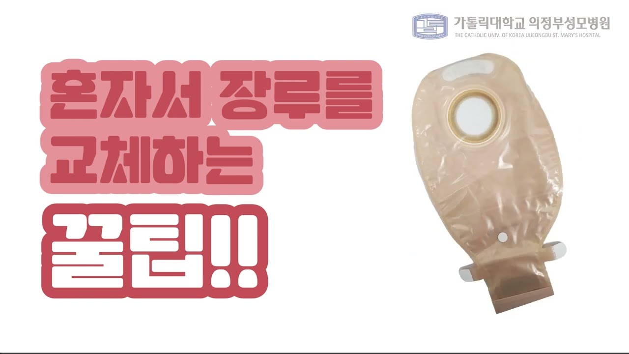 장루 교육 영상 두번째, "장루는 어떻게 관리하는 것이 좋을까?" - 의정부성모병원 대장암센터