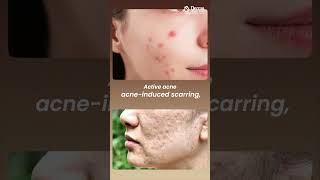 “I Want Filter-Like Skin!” Can Dermatology Really Give You Perfect Skin?
