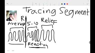 Polygraph Tracing segments 