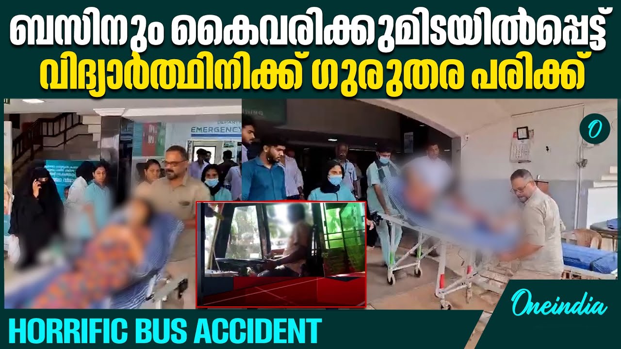 സ്വകാര്യ ബസിന്റെ അമിതവേഗത;വിദ്യാർത്ഥിനി ബസിനും കൈവരിക്കുമിടയിൽ കുടുങ്ങി RASH DRIVING;STUDENT CRUSHED