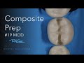 COMPOSITE PREP #19 MOD Acadental M 300   HD 1080p