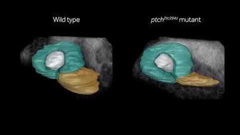 Zebrafish eye morphogenesis - with help from Hedgehog