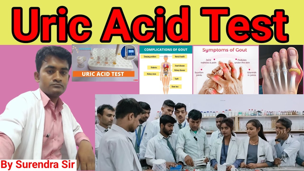 Uric Acid Test  Uric Acid Test Procedure 
