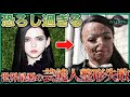 【閲覧注意】世界最悪の芸能人整形失敗10選!医療ミスで"人形怪物"化…1位は恋人が失禁するほどの衝撃【整形依存症】
