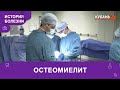 Остеомиелит | История болезни