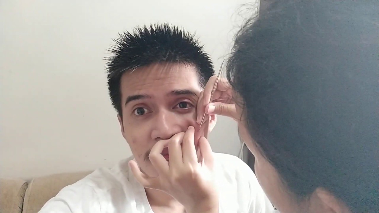 Perawat Jerawat 