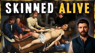 What Being Skinned Alive Was Really Like