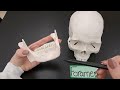Bone Markings Quiz