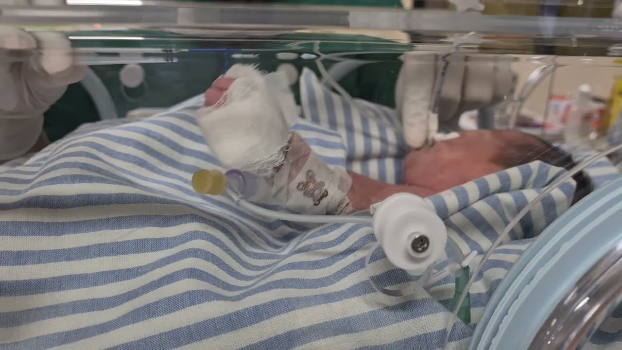 Introdução de Sonda Orogástrica em RN