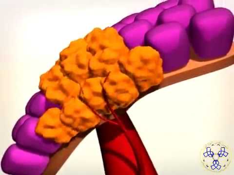 تصویری: آیا شیمی درمانی خوراکی به همان اندازه شیمی درمانی تزریقی مثر است؟