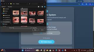 Automated Eye Disease Detection | Project Demo screenshot 4