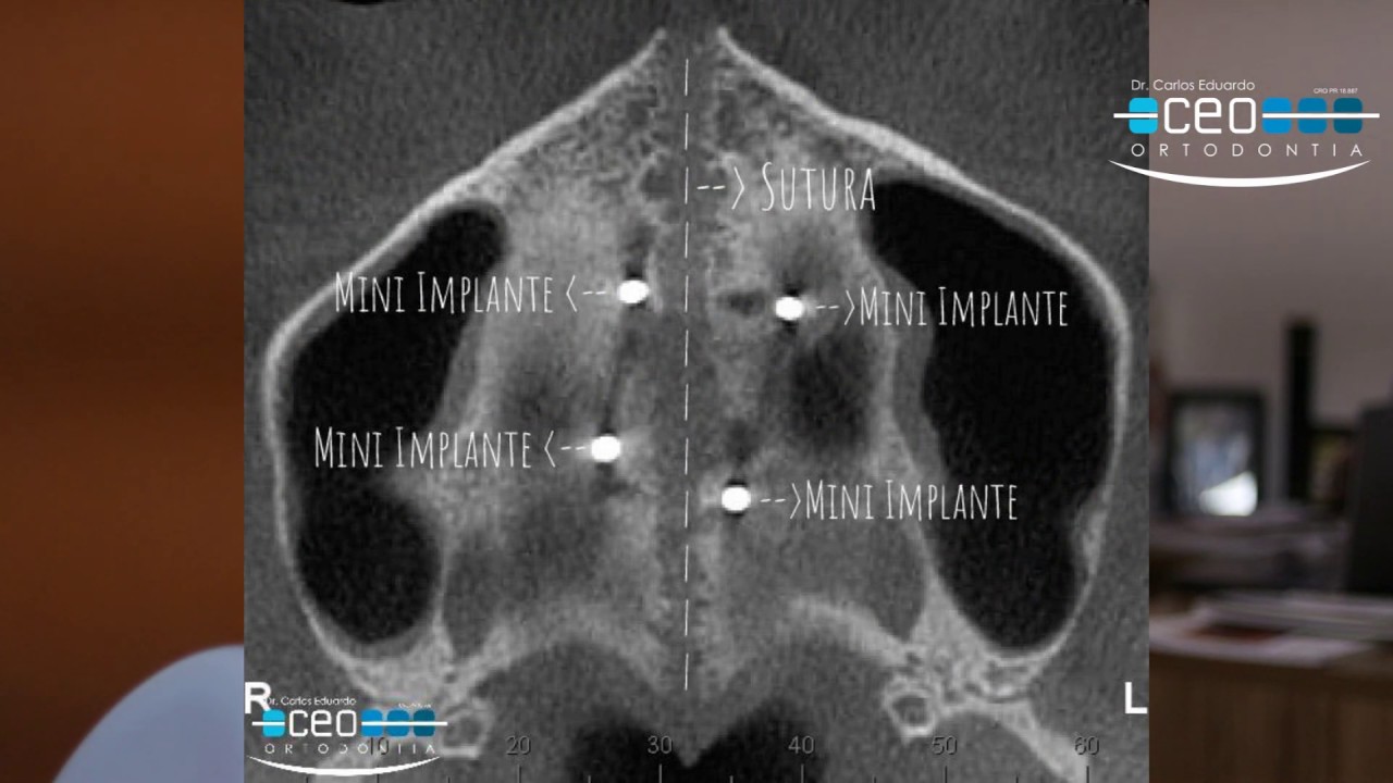MARPE, exames, planejamento e sucesso