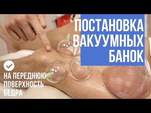 Боли в коленях. Болит поясница. Вакуумный массаж на передней поверхности бедра