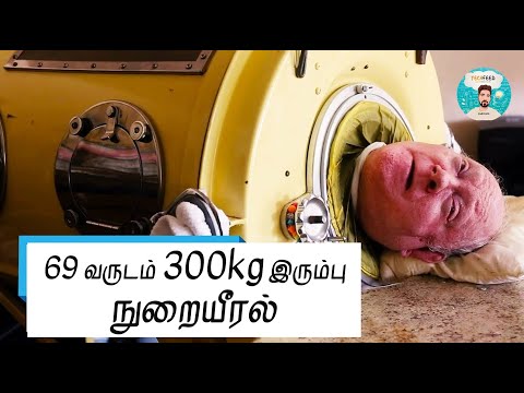 யார் இந்த Paul Alexander? Iron Lung | Polio | Techfeed