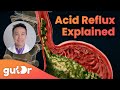 What is acid reflux  the gutdr explains 3d gut animation