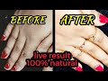 കൈകൾക്ക് ഇത്ര ഭംഗിയോ//manicure at home setup //💯natural //ZERO COST