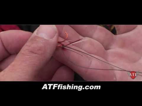 How To Remove A Hook From Finger (REAL FOOTAGE!)