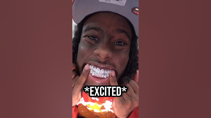 Kai Cenat Gets Gifted $50,000 Grills!😭😂