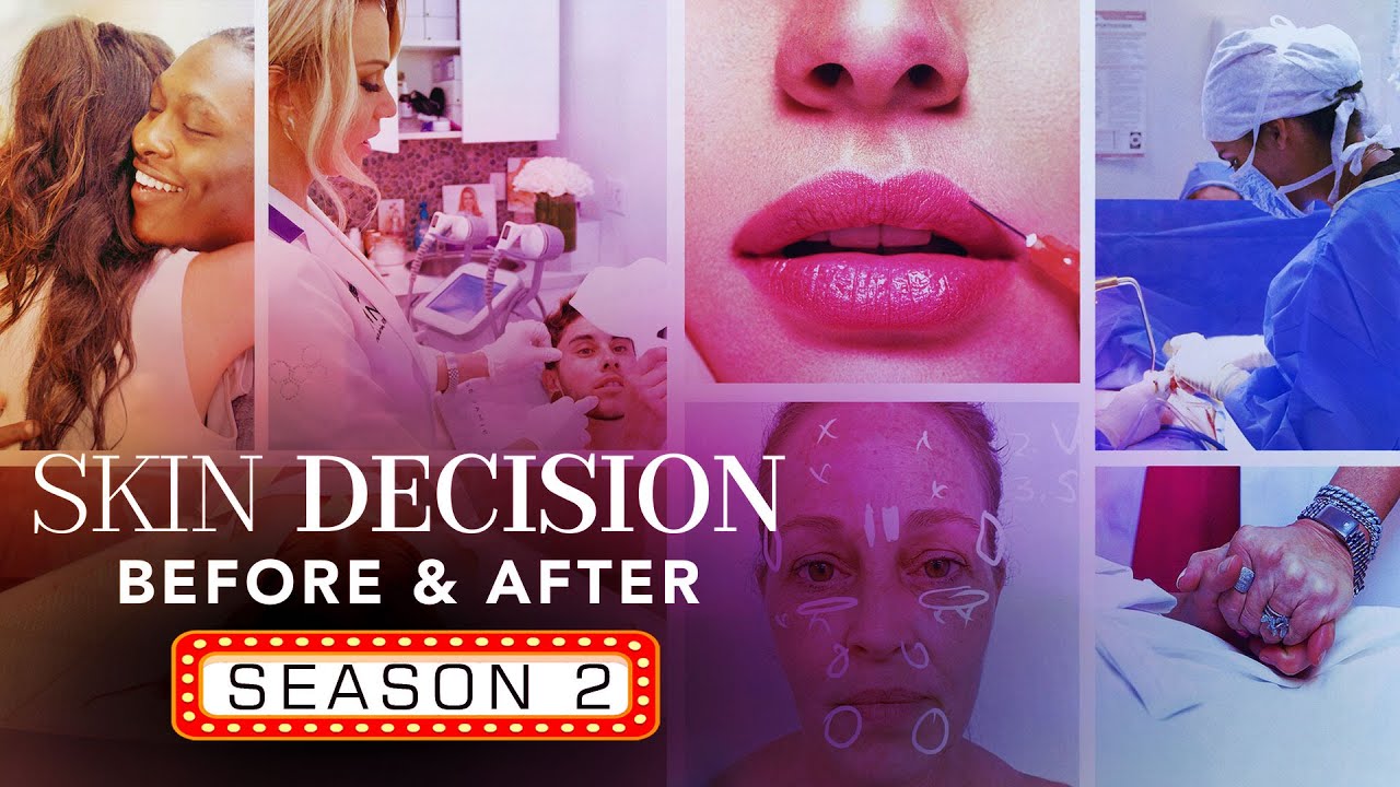Skin Decision Season 2 Release Date, Plot, Cast, And More Information - Release on Netflix